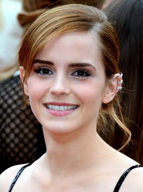 Emma Watson has ADHD